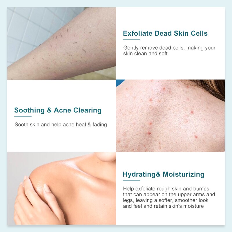 Seekpretty BHA Soothing Body Wash Anti-Acne Remover Removes Blackheads Exfoliates Pores Reduces Wrinkles Brightens Skin Care - mybesthealthandwellness