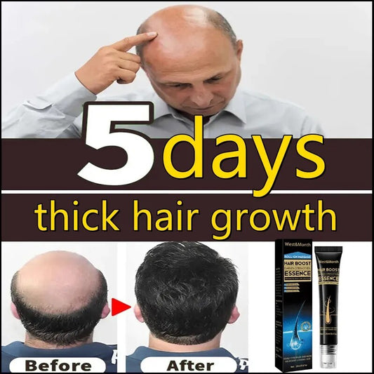 Fast Hair Growth Essence Effective Anti Hair Loss Serum Baldness Repair Hereditary Postpartum Seborrheic Hair Loss Hair Care