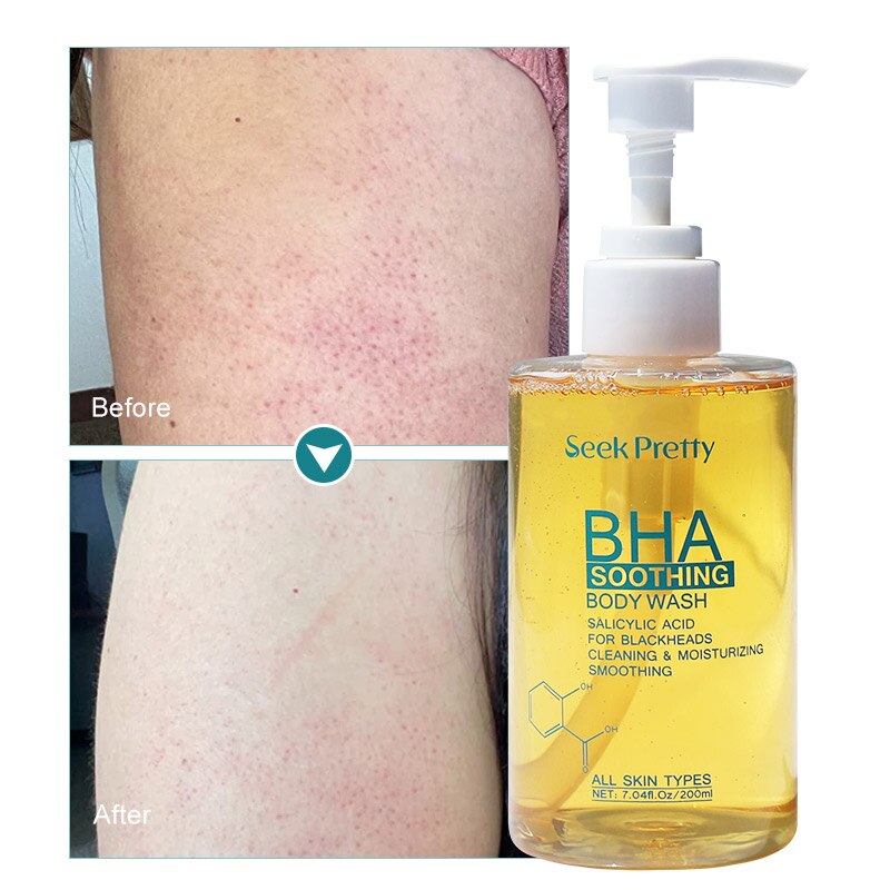 Seekpretty BHA Soothing Body Wash Anti-Acne Remover Removes Blackheads Exfoliates Pores Reduces Wrinkles Brightens Skin Care - mybesthealthandwellness