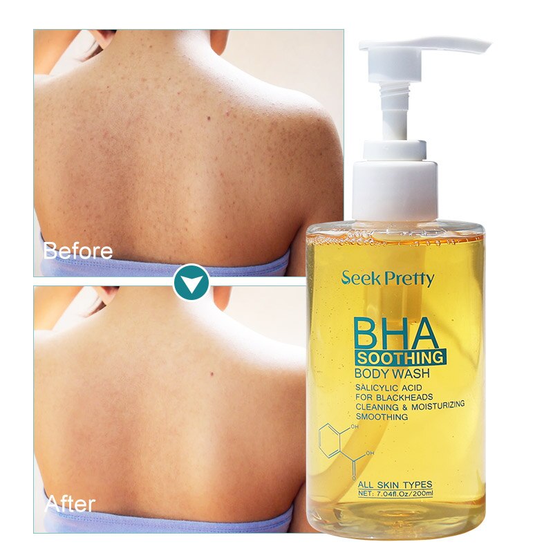 Seekpretty BHA Soothing Body Wash Anti-Acne Remover Removes Blackheads Exfoliates Pores Reduces Wrinkles Brightens Skin Care - mybesthealthandwellness