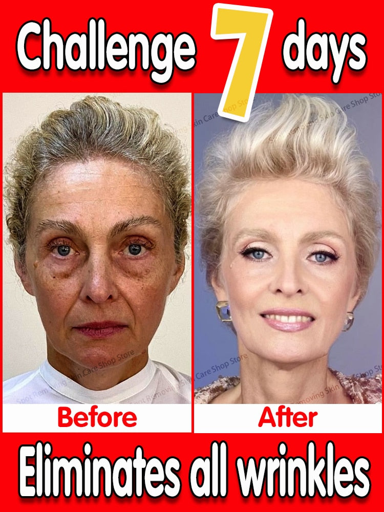 Instant Wrinkle Remover Face Serum Lifting Firming Fade Fine Lines Anti-aging Essence Whitening Brighten Nourish Skin Care - mybesthealthandwellness